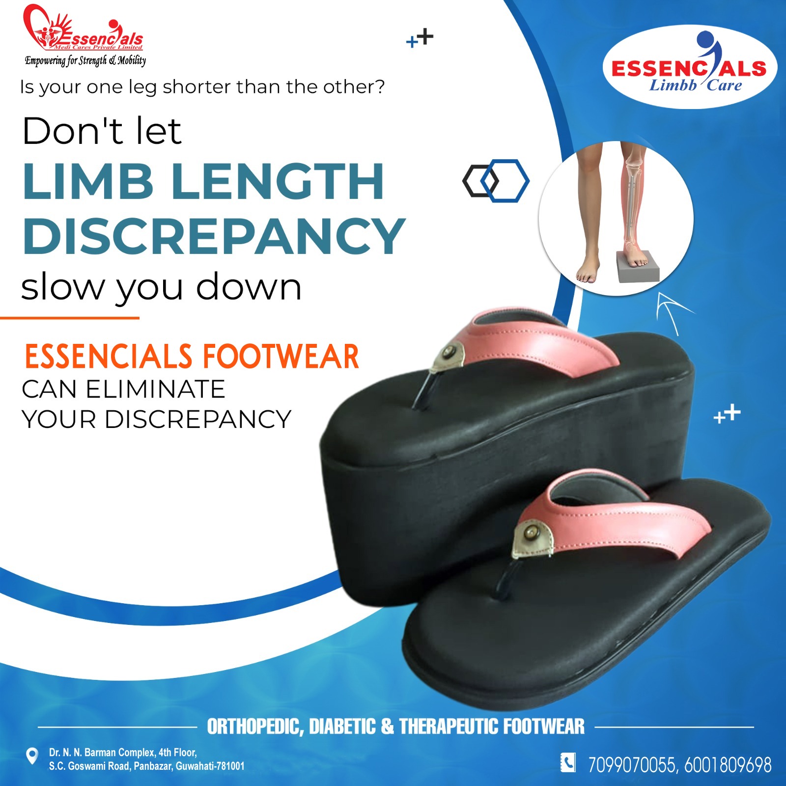 Limb discrepancy Orthopedic footwear